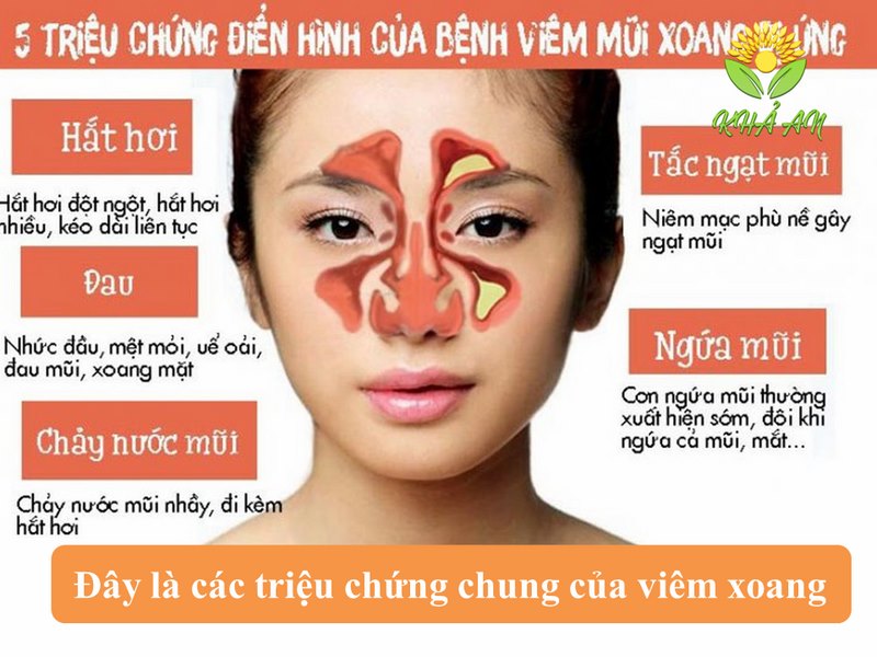 massage-bam-huyet-nhu-the-nao-de-tri-viem-xoang-1