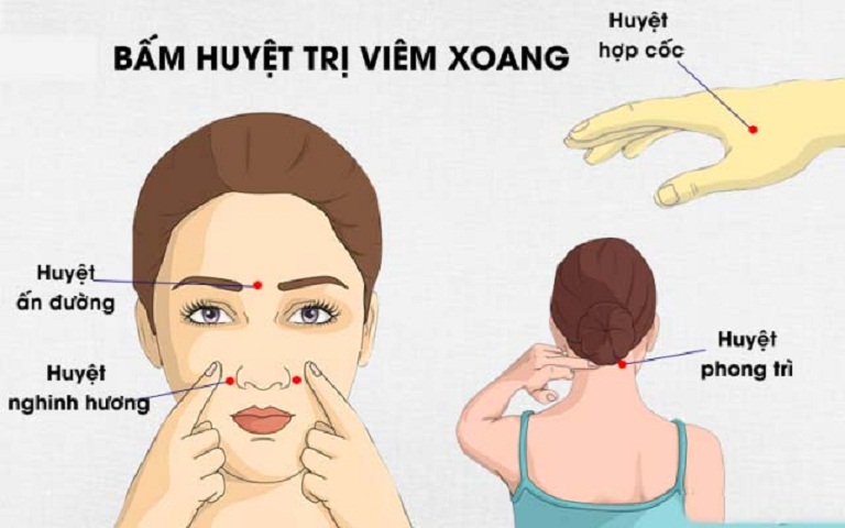 Massage bấm huyệt như thế nào để trị viêm xoang?