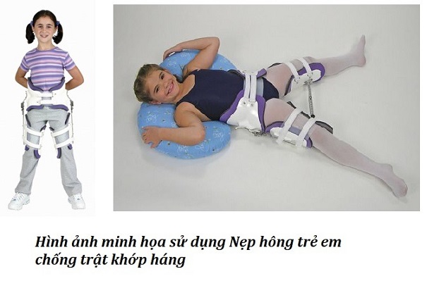 Nẹp hông trẻ em